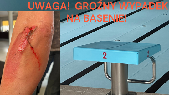 Kobieta poślizgnęła się w saunie i doznała poparzenia II stopnia